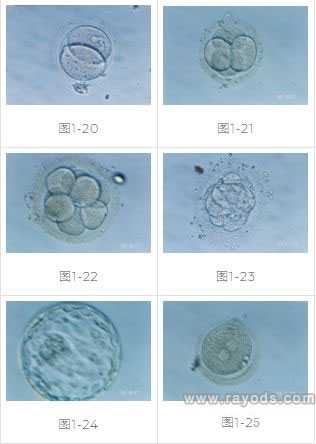 厦门借卵做试管代孕,试管婴儿胚胎移植具体过程及方式-上海供卵试管生子多少