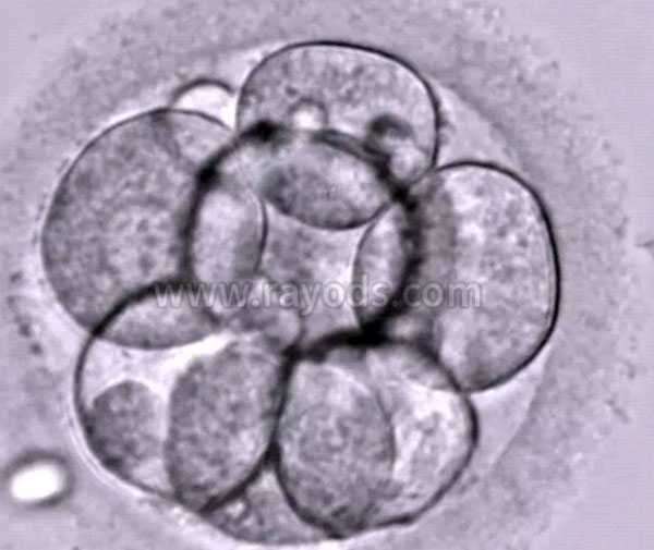吉林那里代孕最权威,【胚胎等级】试管胚胎等级是什么意思，等级怎么区分。