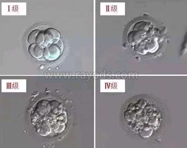 吉林那里代孕最权威,【胚胎等级】试管胚胎等级是什么意思，等级怎么区分。