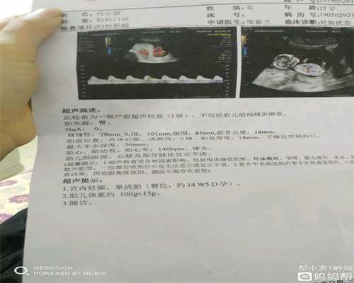 上海最大的代孕结构_上海添禧代怀孕套餐_晚断脐