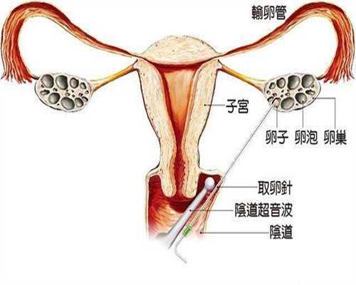 上海世纪代怀孕国际_上海有没有代孕妈妈吗_广东