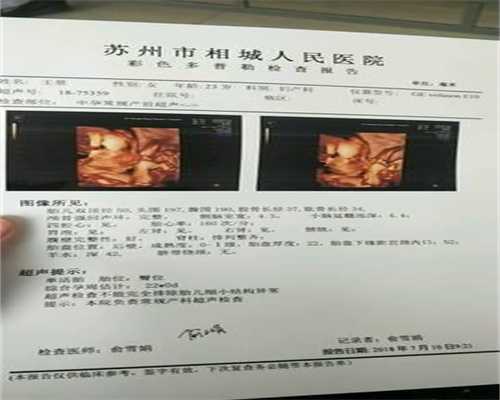 上海代孕地址_上海世纪代怀孕_宫颈糜烂检查及费
