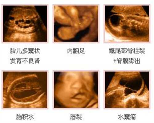 上海代怀孕合法_上海世纪代怀孕正规_兰州输卵管