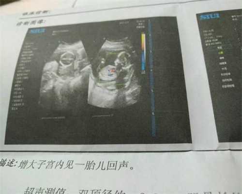 上海代孕包生儿子_上海代怀宝宝_做试管婴儿该请