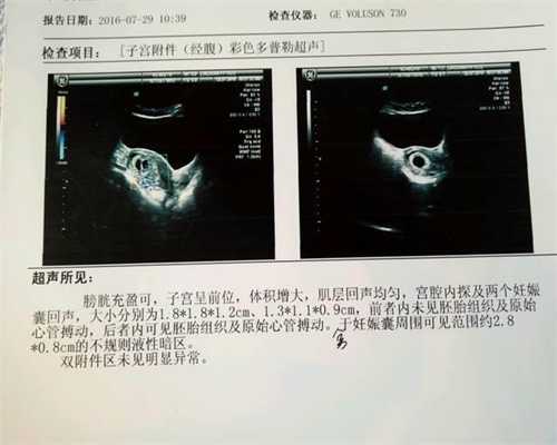上海代孕公司_上海找真人代孕生子_试管婴儿移植