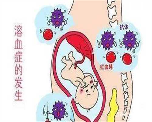 上海代孕包性别_代孕公司上海_上海坤和助孕中心
