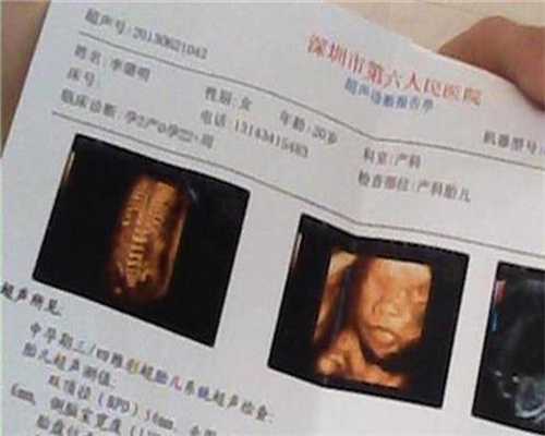 上海代孕服务_代生宝宝价格多少上海_药物促卵超