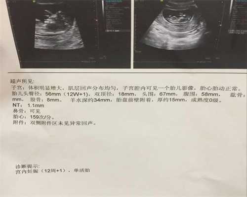 上海代怀孕哪家好_上海代孕可行性_婴儿脐带血保