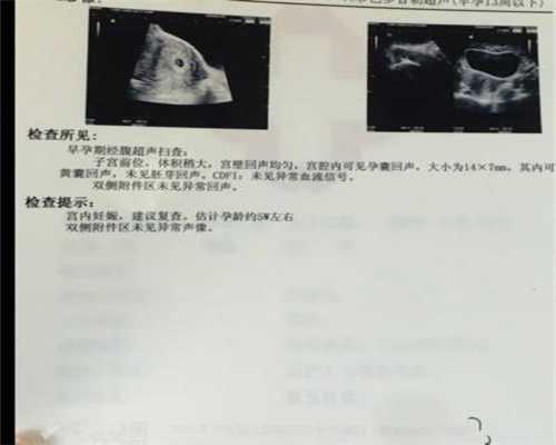 代孕政策江西代孕_代孕和试管婴儿的区别_孕2月