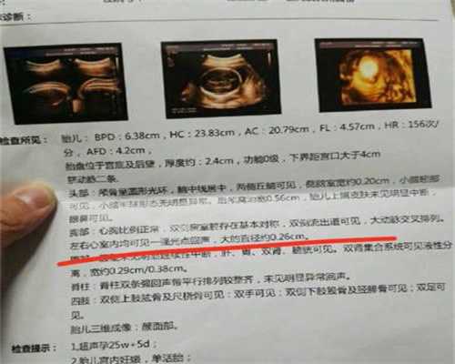 上海专业代怀孕零首付:怀孕后贫血怎么办