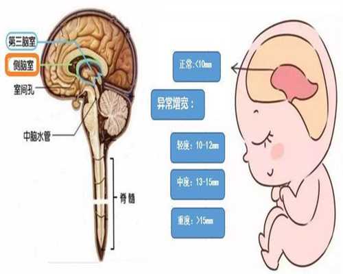 上海代孕产子价格介绍:单角子宫孕妇能足月吗