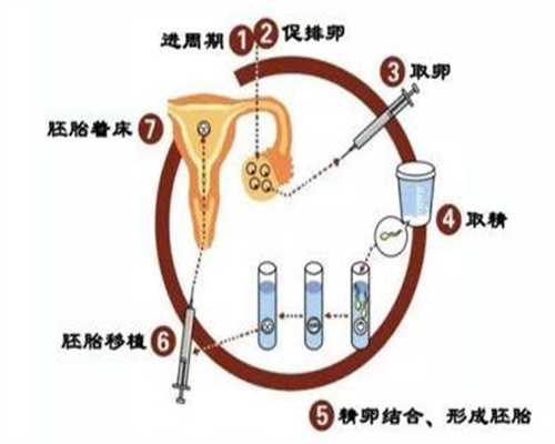 上海职业代孕-阴超可以看子宫下垂吗