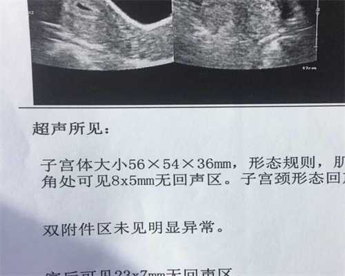 上海代孕费用和成功率-孕酮每次都低是什么原因