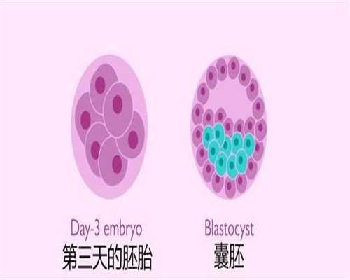 上海代孕中心怎么样-剖腹产时可以戴隐形眼睛吗