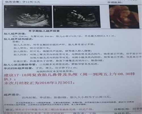 上海做代孕医院排名-新生儿脑瘫怎么检查