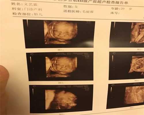 上海女找男人代孕_上海现在在可以代孕吗_天若助孕-输卵管造影做完后可以上班