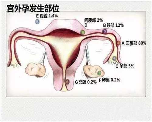 上海试管代孕产子流程_上海代孕生子QQ群_东骏助孕中心安全吗-输卵管阻塞有哪