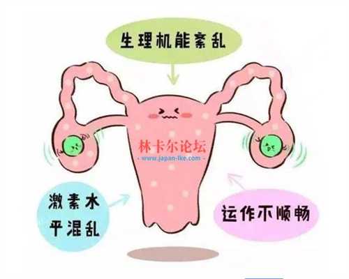 上海借腹生子包成功_上海为生儿子找代孕_嘉宝助孕官网-子宫内膜异位症累计