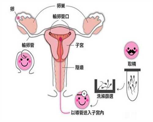 上海不想生孩子可以代孕吗_上海做代孕费用需要多少
