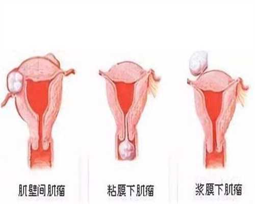 上海去找代孕怎么办理手续_上海做代孕需要