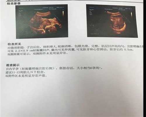 上海助孕试管婴儿_上海代孕选性别
