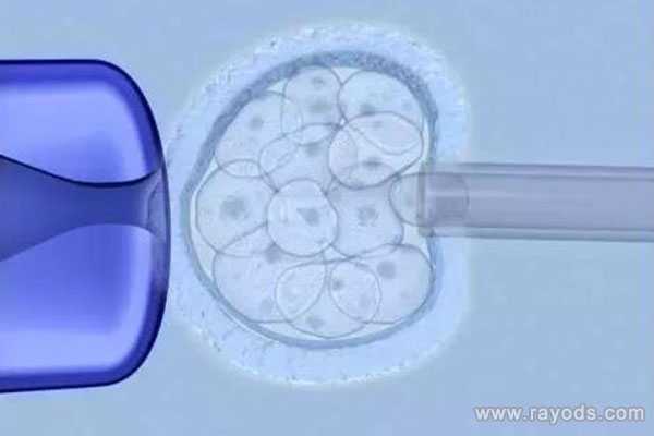 盐城借卵做试管的故事_盐城借卵子生孩子_泰国试管婴儿专家分析：养囊的两个
