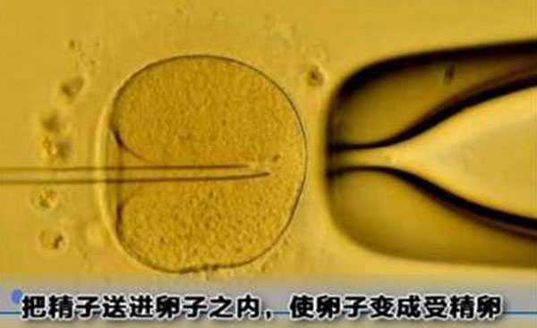 深圳52岁供卵试管单次成功率_试管婴儿手术取卵是不是很疼，打没有打麻药，对